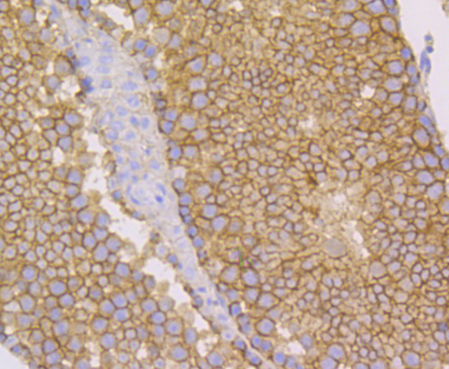 Nectin 2 Rabbit mAb