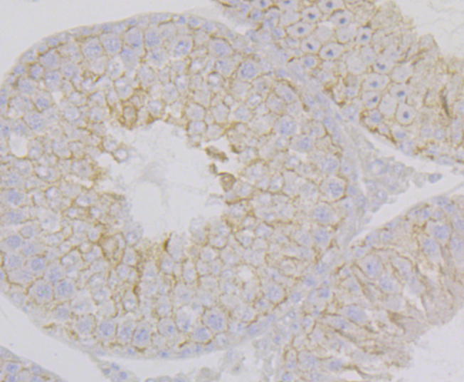 Nectin 2 Rabbit mAb