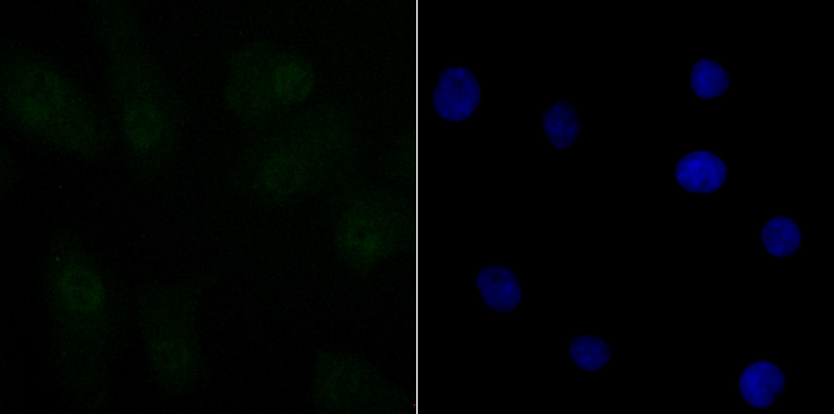 CtBP1 Rabbit mAb