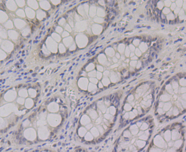 CtBP1 Rabbit mAb