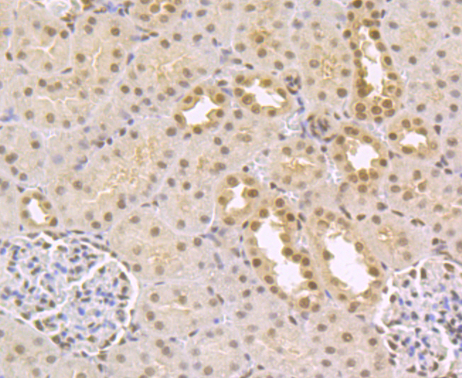 CtBP1 Rabbit mAb