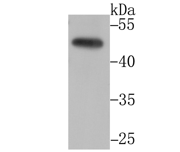 CtBP1 Rabbit mAb