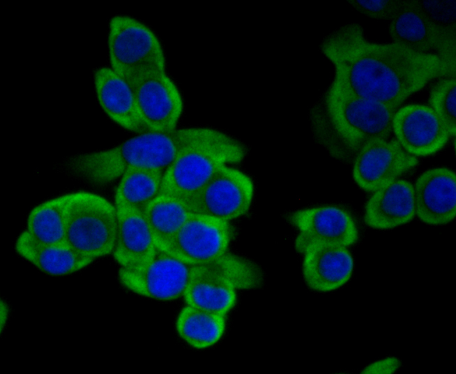 Methionine Aminopeptidase 2 Rabbit mAb