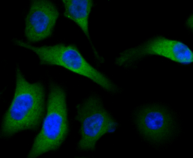 Methionine Aminopeptidase 2 Rabbit mAb