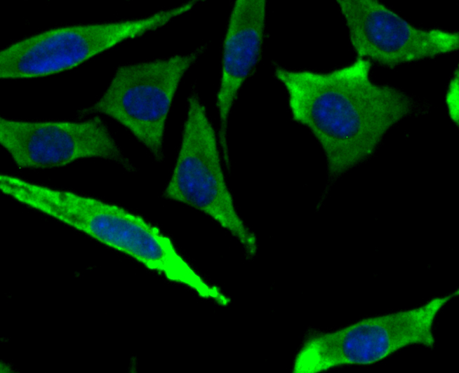 Methionine Aminopeptidase 2 Rabbit mAb