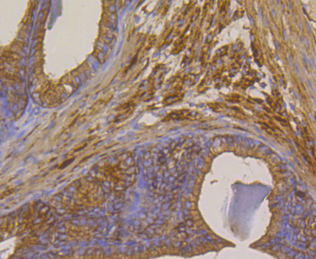 Methionine Aminopeptidase 2 Rabbit mAb