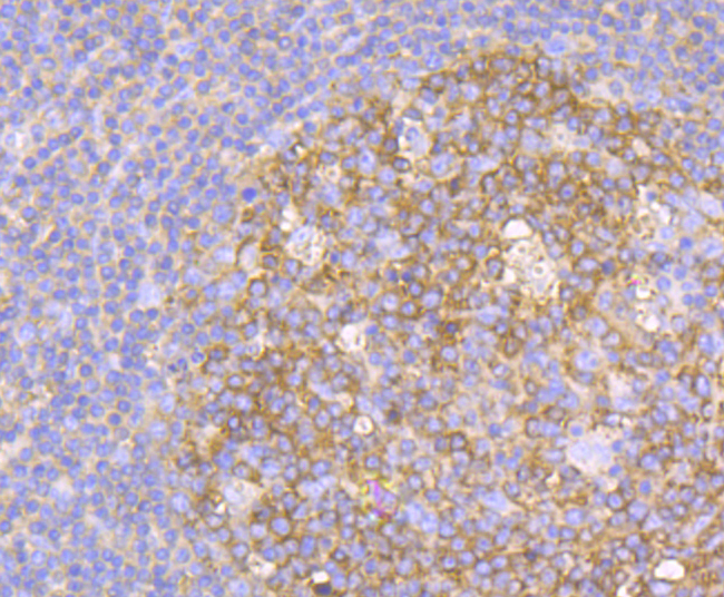 Methionine Aminopeptidase 2 Rabbit mAb