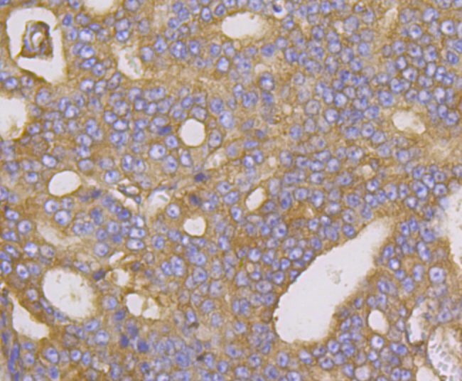 Methionine Aminopeptidase 2 Rabbit mAb