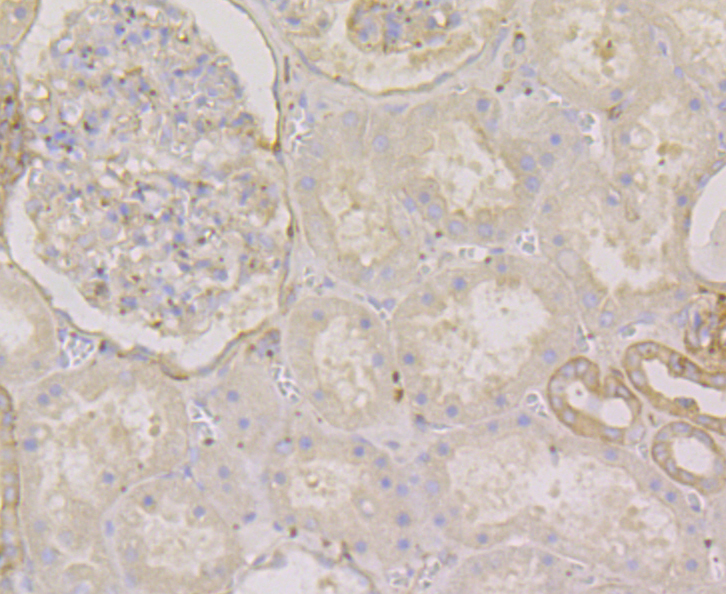 Methionine Aminopeptidase 2 Rabbit mAb