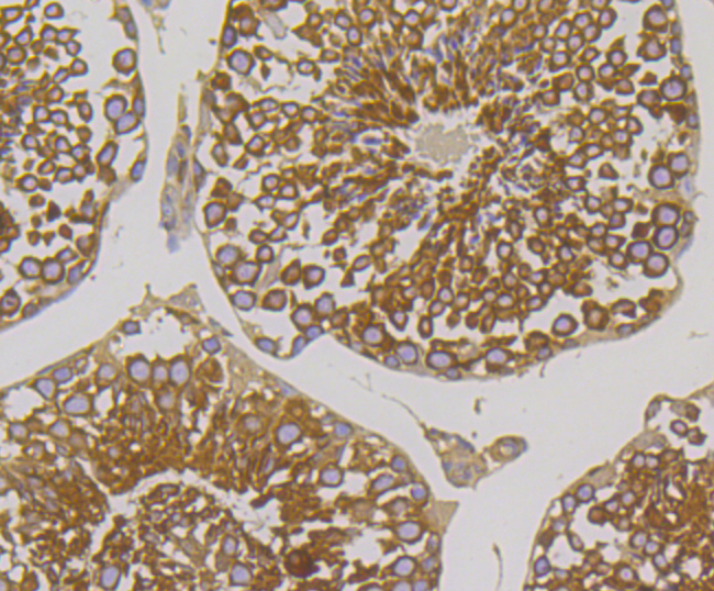 Methionine Aminopeptidase 2 Rabbit mAb