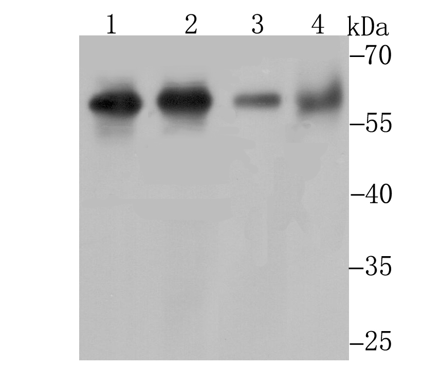 Methionine Aminopeptidase 2 Rabbit mAb