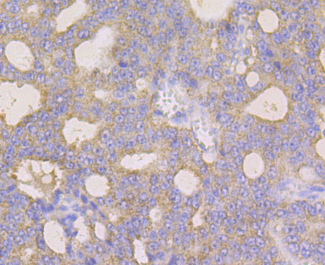 Monoamine Oxidase B Rabbit mAb