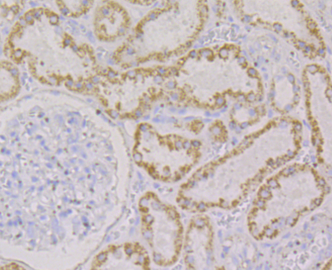 Monoamine Oxidase B Rabbit mAb