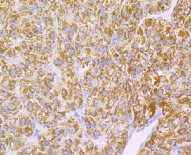 Monoamine Oxidase B Rabbit mAb