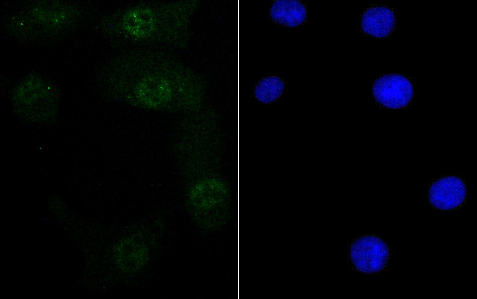 Retinoid X Receptor alpha Rabbit mAb