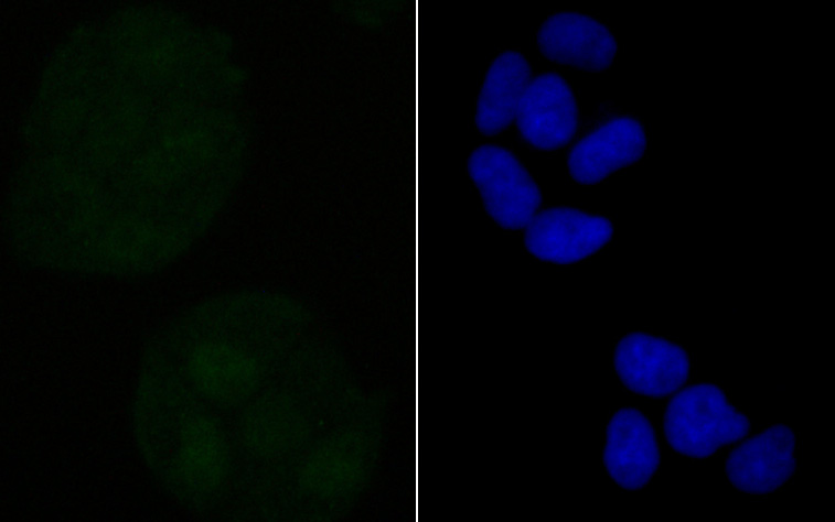 Retinoid X Receptor alpha Rabbit mAb