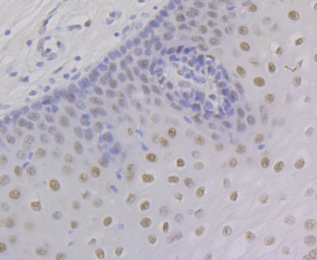 Retinoid X Receptor alpha Rabbit mAb