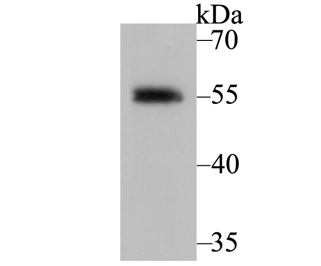 Retinoid X Receptor alpha Rabbit mAb