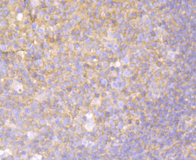 MGEA5 Rabbit mAb