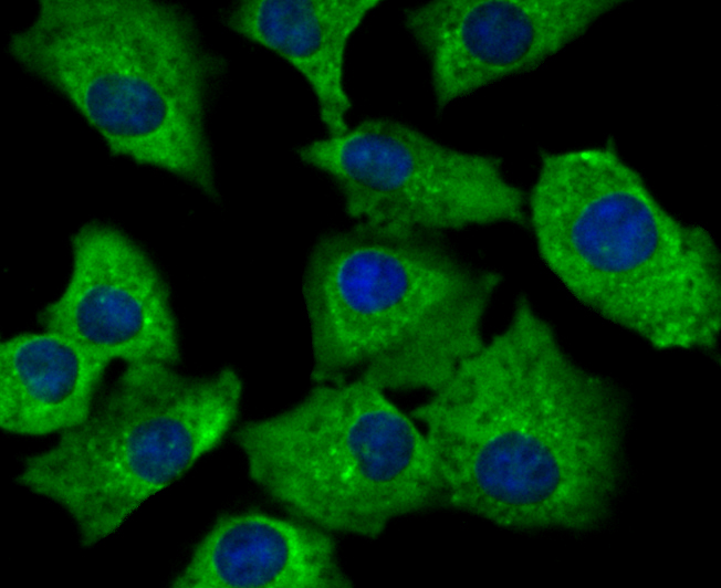 SNX1 Rabbit mAb