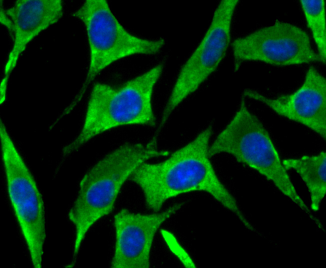 SNX1 Rabbit mAb