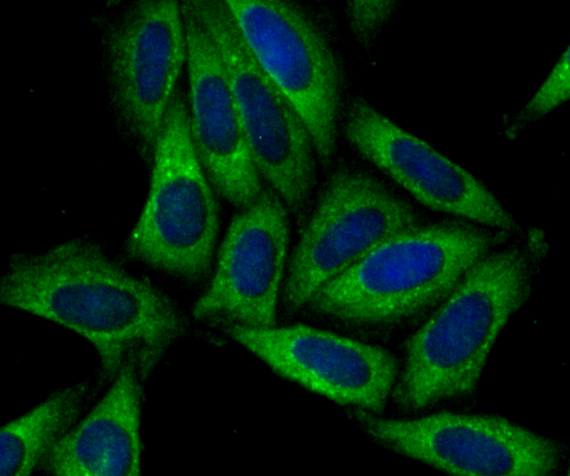 SNX1 Rabbit mAb