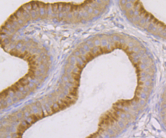 SNX1 Rabbit mAb