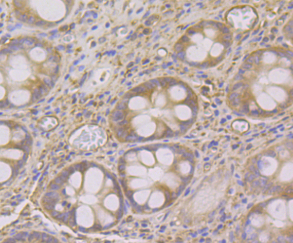 SNX1 Rabbit mAb