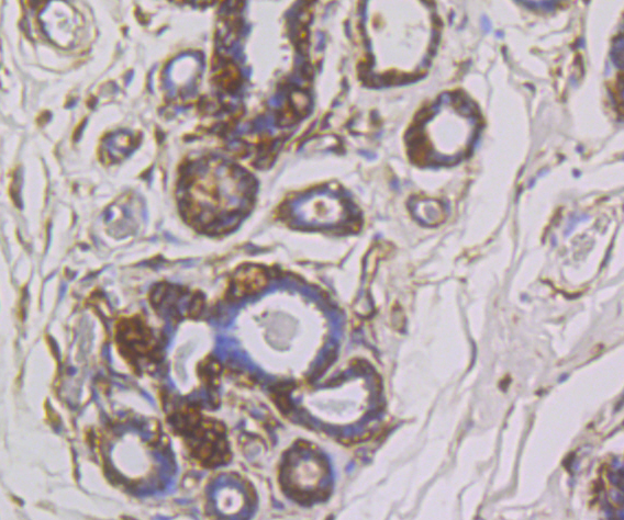 SNX1 Rabbit mAb