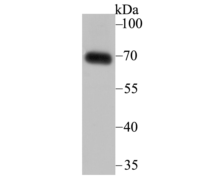 SNX1 Rabbit mAb