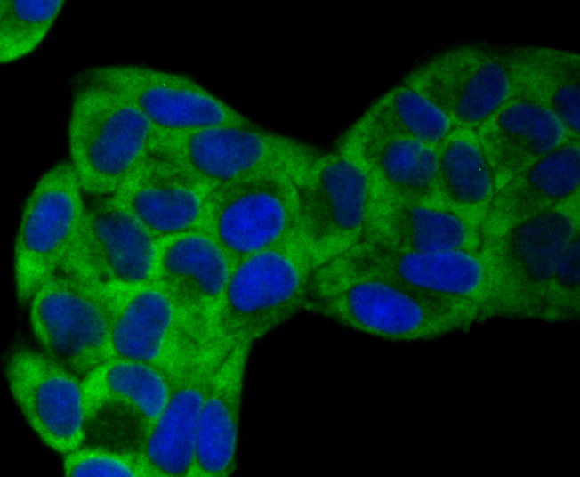 VAMP1 Rabbit mAb