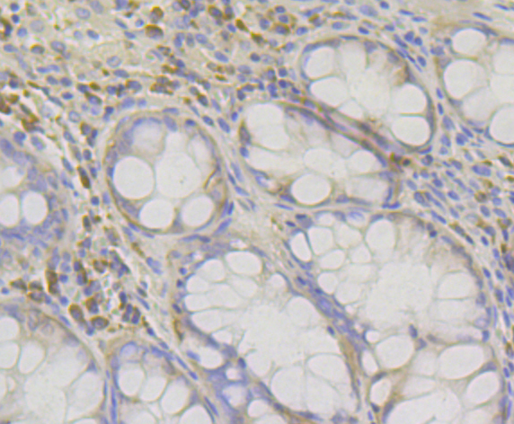 RACK1 Rabbit mAb