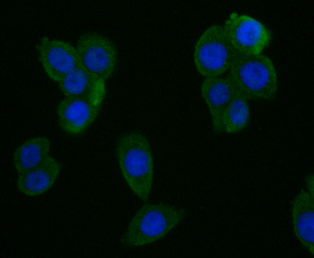 CYP27A1 Rabbit mAb