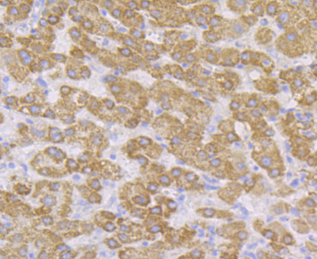 CYP27A1 Rabbit mAb