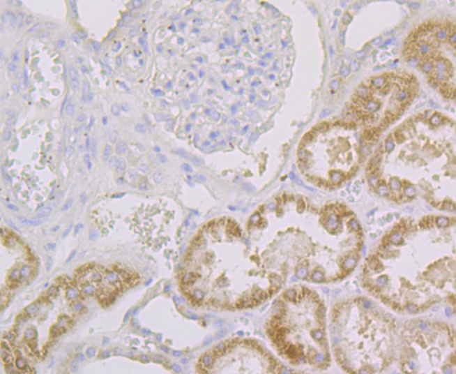 CYP27A1 Rabbit mAb