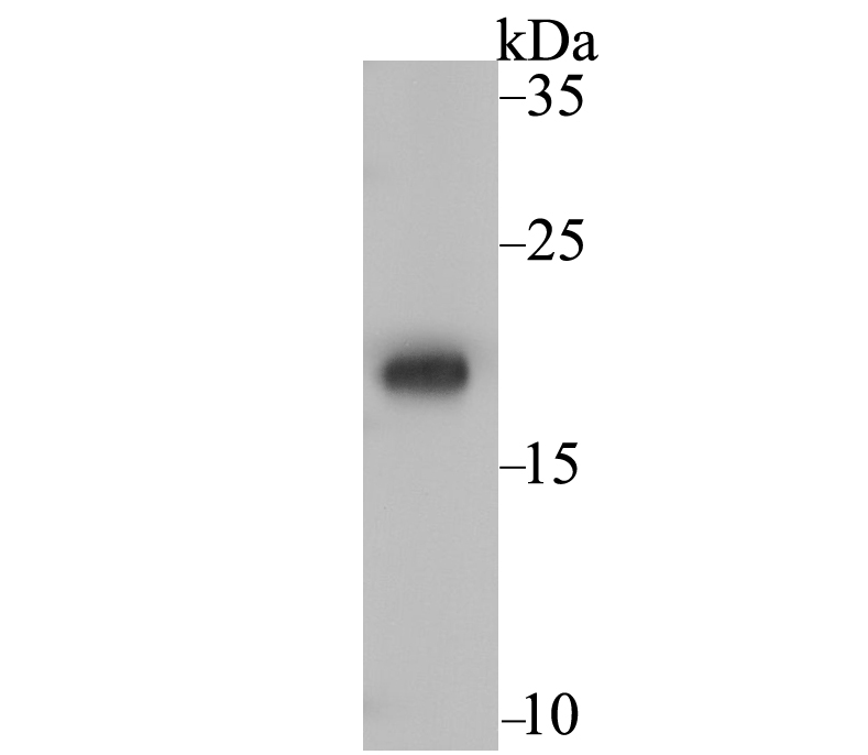 Ndufs4 Rabbit mAb