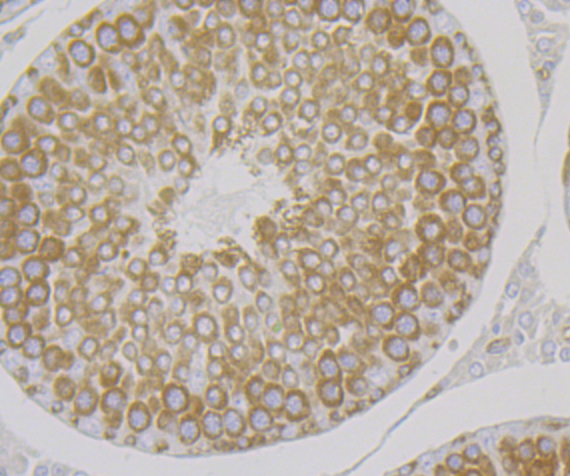 Lysyl tRNA synthetase Rabbit mAb