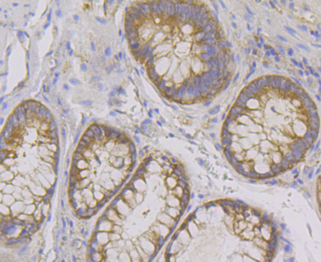 Lysyl tRNA synthetase Rabbit mAb