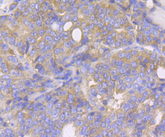 Lysyl tRNA synthetase Rabbit mAb