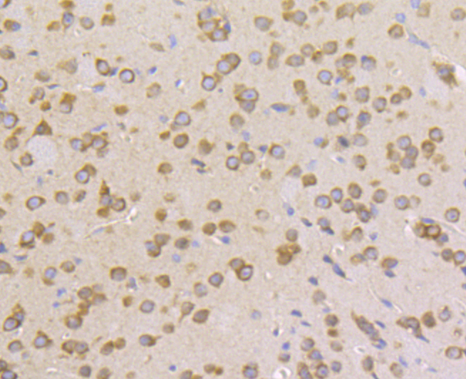 Lysyl tRNA synthetase Rabbit mAb