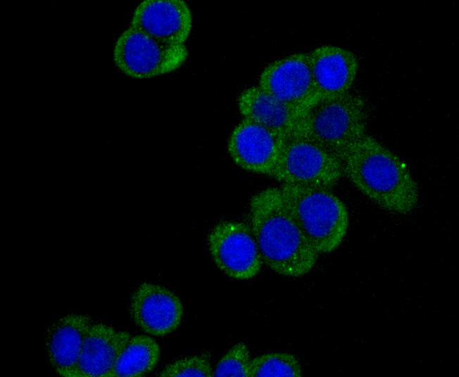 DIAPH1 Rabbit mAb