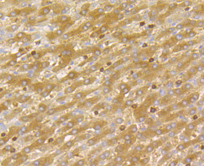 DIAPH1 Rabbit mAb