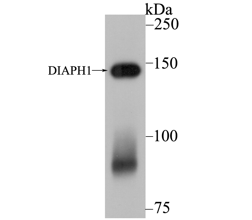 DIAPH1 Rabbit mAb