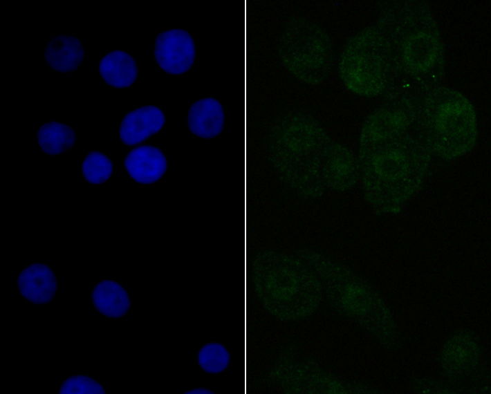 NXF1 Rabbit mAb