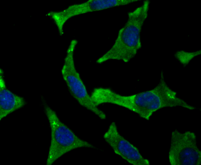 Syntenin Rabbit mAb