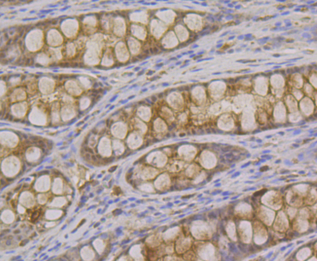 Syntenin Rabbit mAb