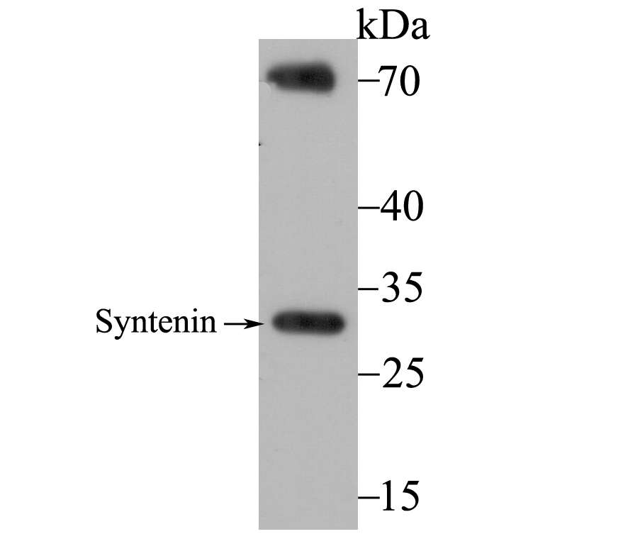 Syntenin Rabbit mAb