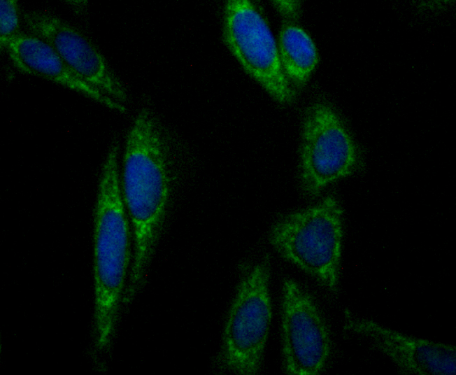 Aconitase 2 Rabbit mAb