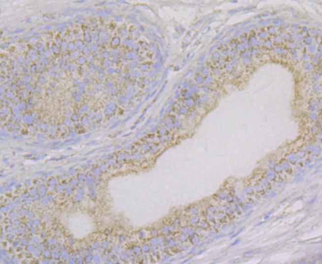 Aconitase 2 Rabbit mAb