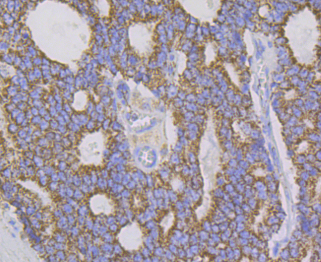 Aconitase 2 Rabbit mAb